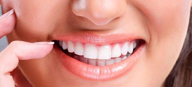 senstitive gums and teeth whitening
