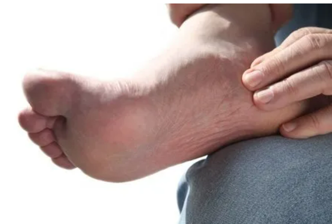 how to manage arthritis pain in feet